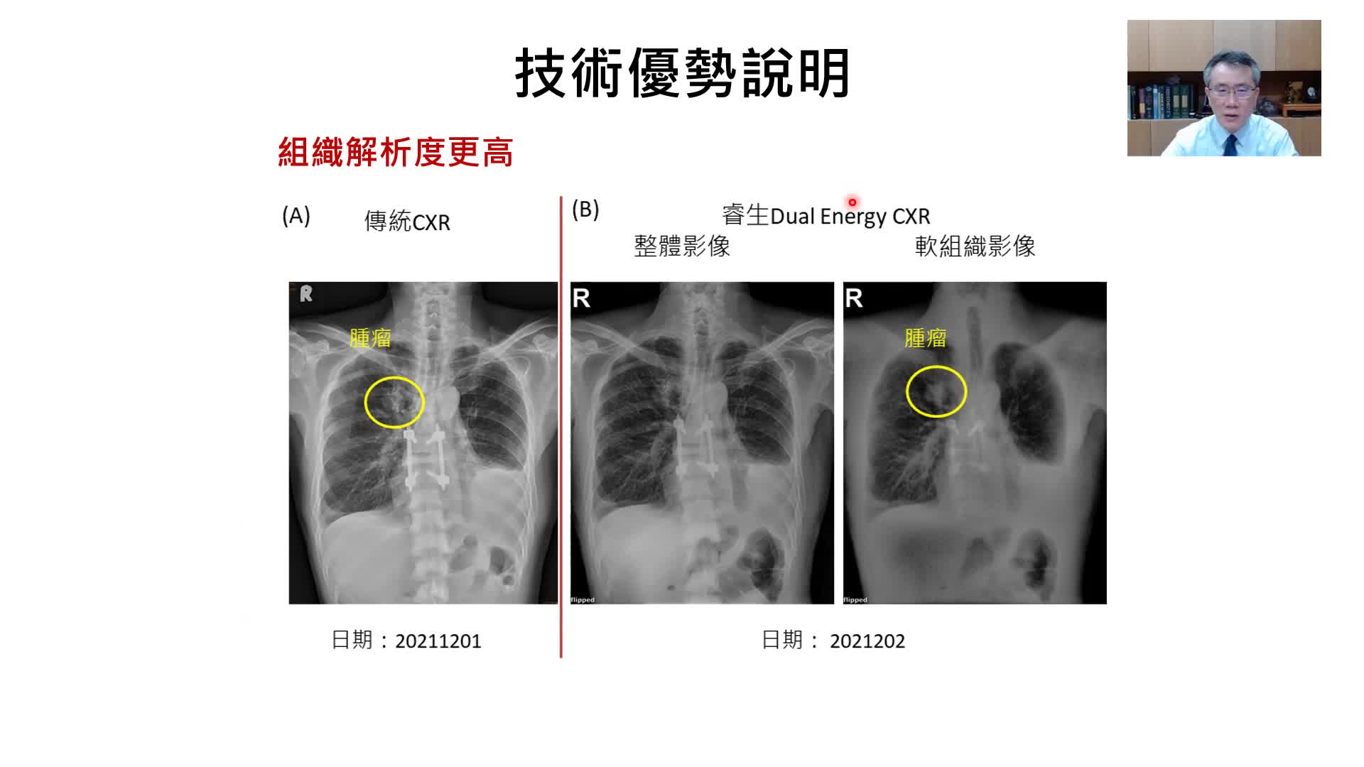 2023) 衛星X光檢查中心強化疾病預防與疾病診斷能量| Healthcare+ B2B 全球醫療採購網